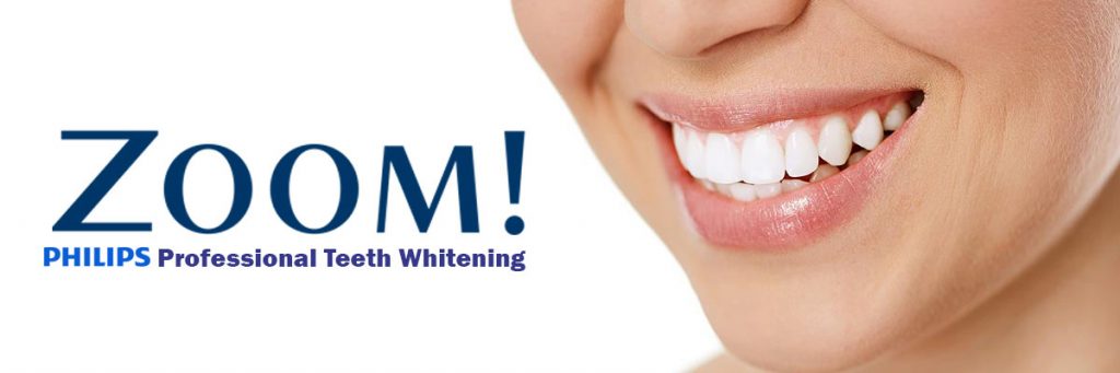 Zoom Teeth Whitening, Nacogdoches Texas