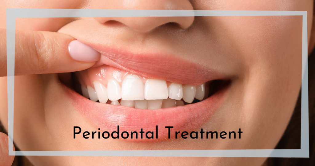 Periodontal Treatment