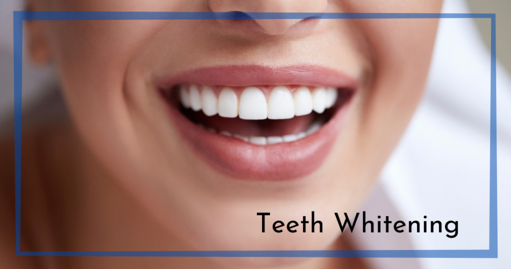 Teeth Whitening