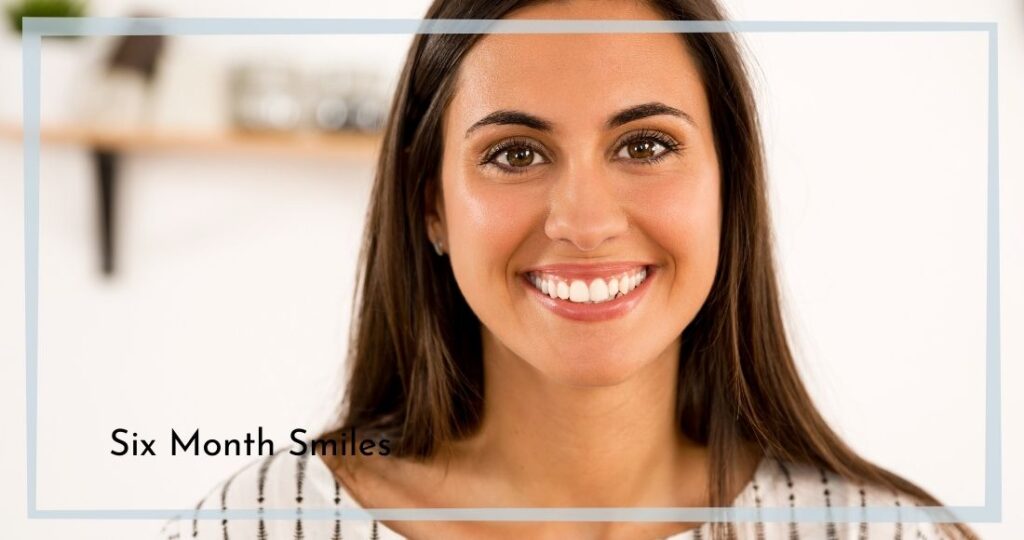 six month smiles